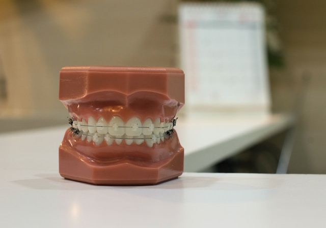 치아교정의 이점과 방법을 알려주기 위한 치아교정을 한 모형장치 사진